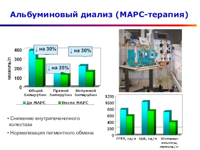 Альбуминовый диализ (МАРС-терапия) ↓ на 35% Снижение внутрипеченочного холестаза Нормализация пигментного