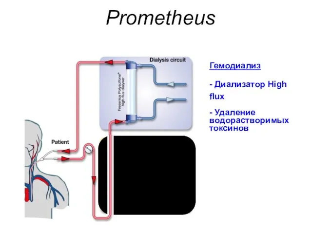 Prometheus Гемодиализ - Диализатор High flux - Удаление водорастворимых токсинов