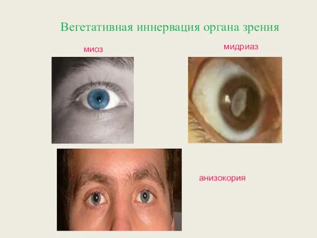 миоз мидриаз анизокория Вегетативная иннервация органа зрения