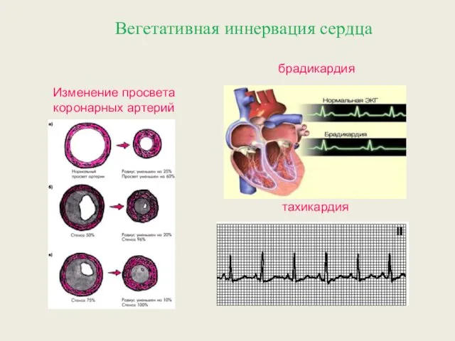 тахикардия брадикардия Изменение просвета коронарных артерий Вегетативная иннервация сердца