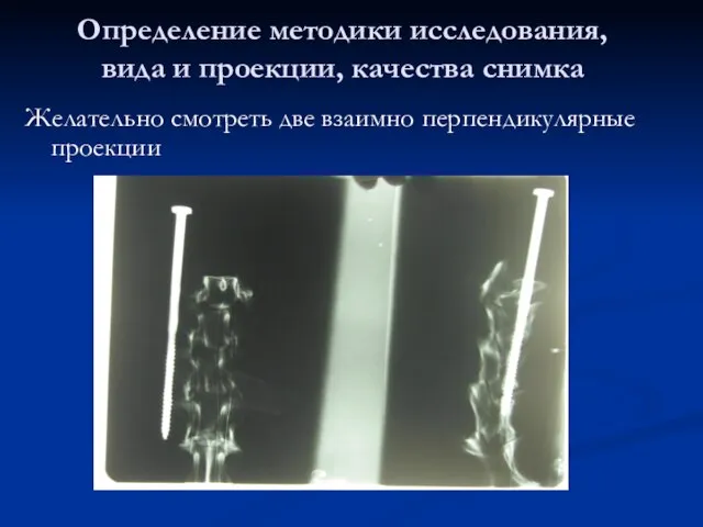 Определение методики исследования, вида и проекции, качества снимка Желательно смотреть две взаимно перпендикулярные проекции