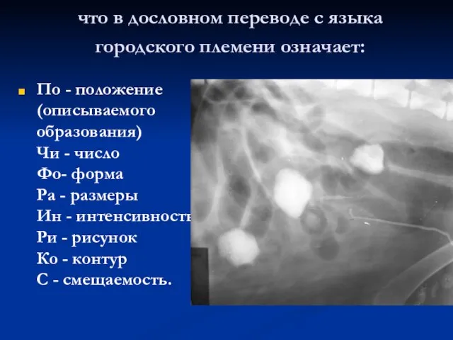 что в дословном переводе с языка городского племени означает: По -