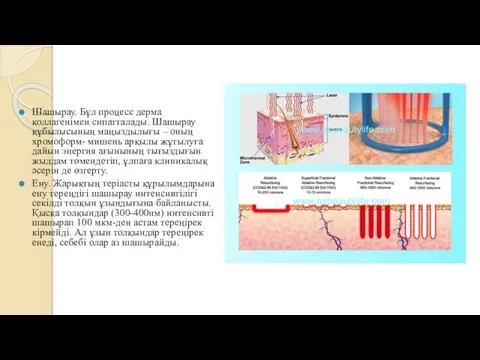 Шашырау. Бұл процесс дерма коллагенімен сипатталады. Шашырау құбылысының маңыздылығы – оның