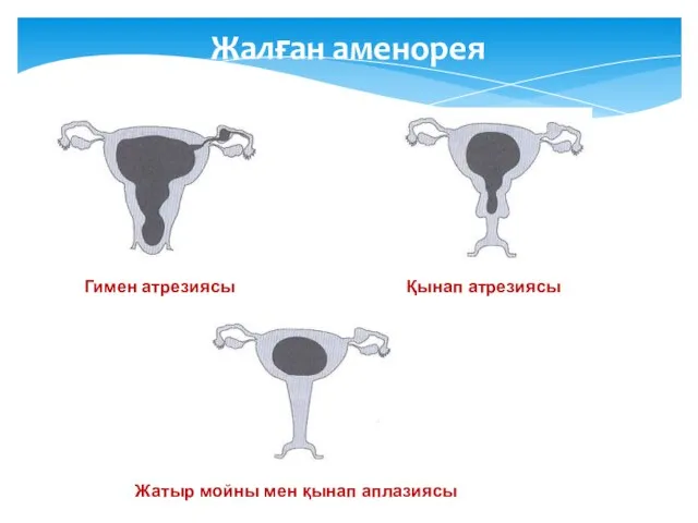 Жалған аменорея Гимен атрезиясы Жатыр мойны мен қынап аплазиясы Қынап атрезиясы