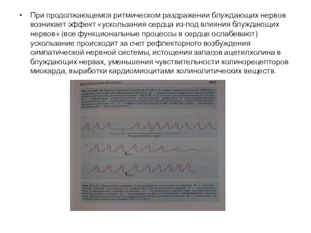 При продолжающемся ритмическом раздражении блуждающих нервов возникает эффект «ускользания сердца из-под