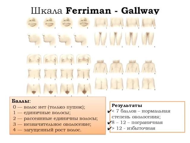 Шкала Ferriman - Gallway Результаты 8 – 12 – пограничная >