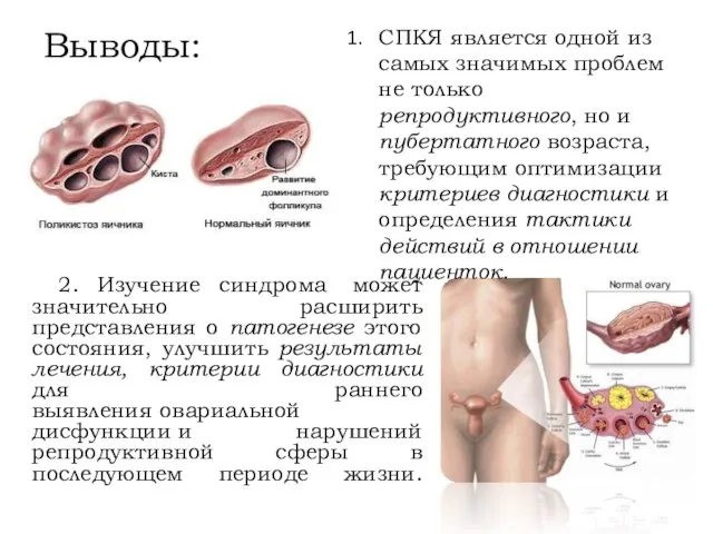 Выводы: 2. Изучение синдрома может значительно расширить представления о патогенезе этого