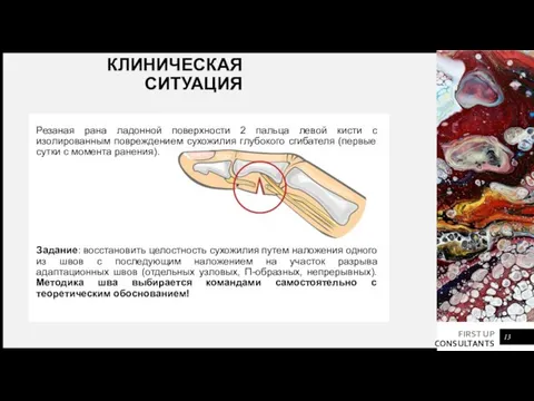 КЛИНИЧЕСКАЯ СИТУАЦИЯ Резаная рана ладонной поверхности 2 пальца левой кисти с