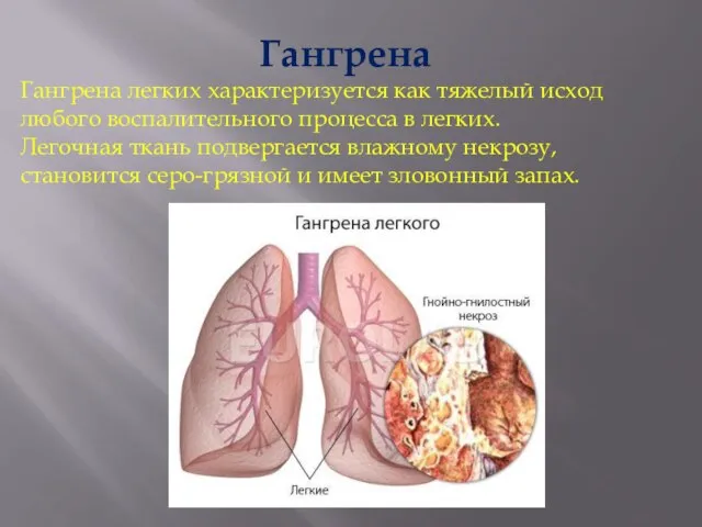 Гангрена Гангрена легких характеризуется как тяжелый исход любого воспалительного процесса в