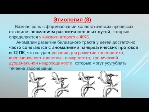 Важная роль в формировании холестатических процессах отводится аномалиям развития желчных путей,