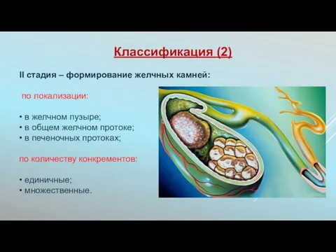 Классификация (2) II стадия – формирование желчных камней: по локализации: •