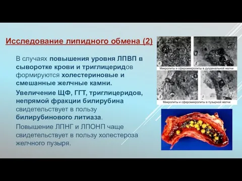 Исследование липидного обмена (2) В случаях повышения уровня ЛПВП в сыворотке