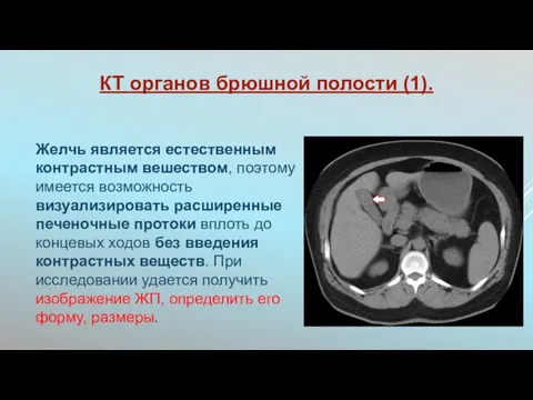 КТ органов брюшной полости (1). Желчь является естественным контрастным вешеством, поэтому