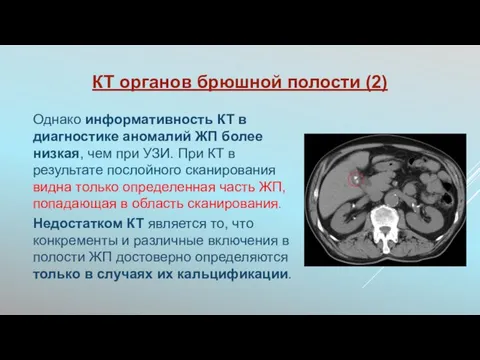 КТ органов брюшной полости (2) Однако информативность КТ в диагностике аномалий