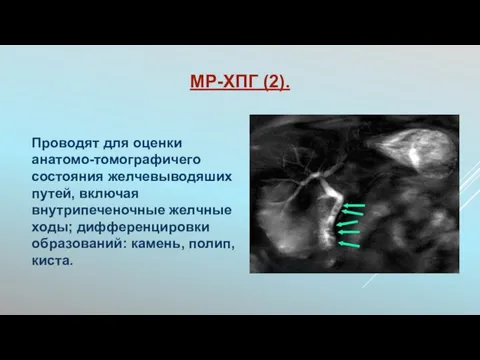 МР-ХПГ (2). Проводят для оценки анатомо-томографичего состояния желчевыводяших путей, включая внутрипеченочные