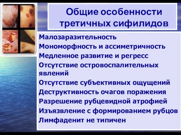 Общие особенности третичных сифилидов Малозаразительность Мономорфность и ассиметричность Медленное развитие и