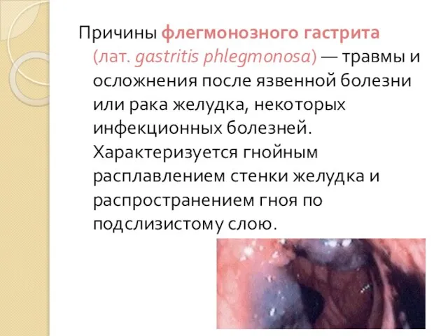 Причины флегмонозного гастрита (лат. gastritis phlegmonosa) — травмы и осложнения после