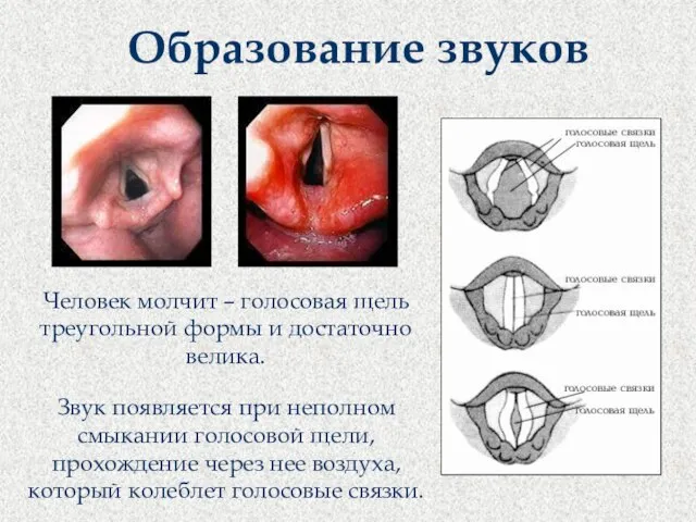 Образование звуков Человек молчит – голосовая щель треугольной формы и достаточно