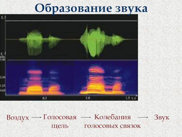 Образование звука Воздух Голосовая щель Колебания голосовых связок Звук