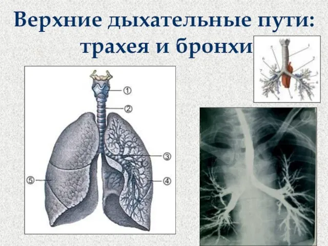 Верхние дыхательные пути: трахея и бронхи