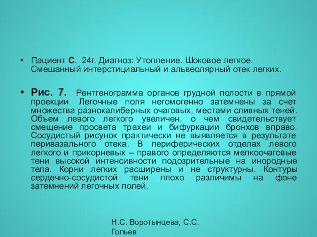 Н.С. Воротынцева, С.С. Гольев Рентгенопульмонология Пациент С. 24г. Диагноз: Утопление. Шоковое