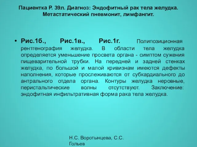 Н.С. Воротынцева, С.С. Гольев Рентгенопульмонология Рис.1б., Рис.1в., Рис.1г. Полипозиционная рентгенография желудка.