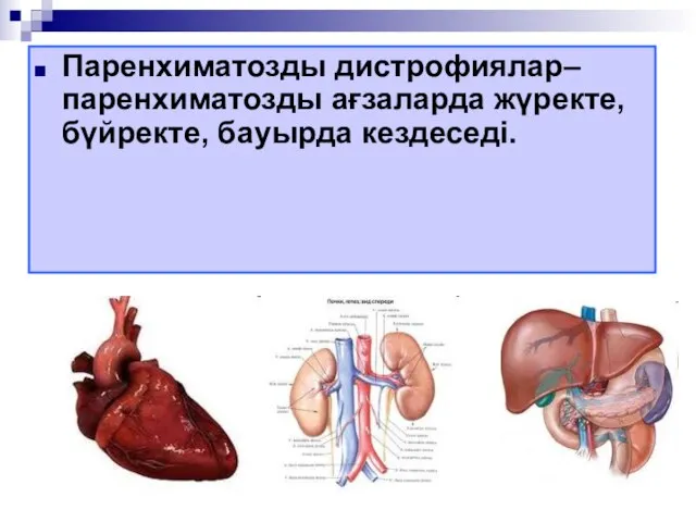 Паренхиматозды дистрофиялар–паренхиматозды ағзаларда жүректе, бүйректе, бауырда кездеседі.