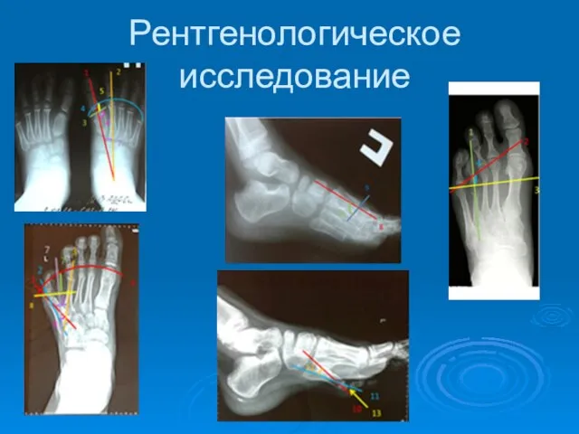 Рентгенологическое исследование