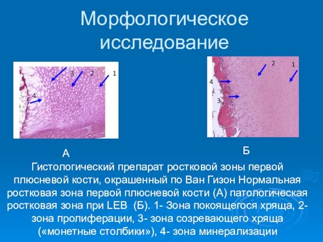 Морфологическое исследование Гистологический препарат ростковой зоны первой плюсневой кости, окрашенный по