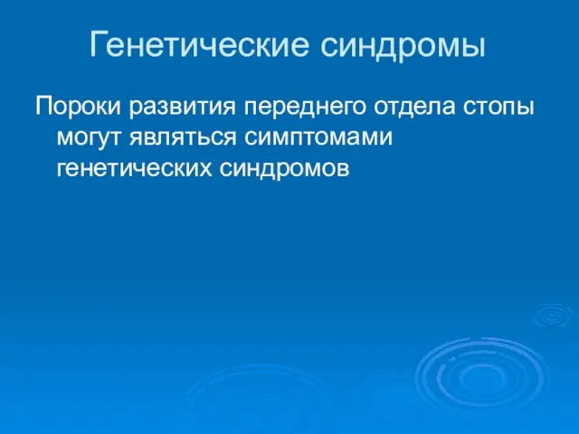 Генетические синдромы Пороки развития переднего отдела стопы могут являться симптомами генетических синдромов