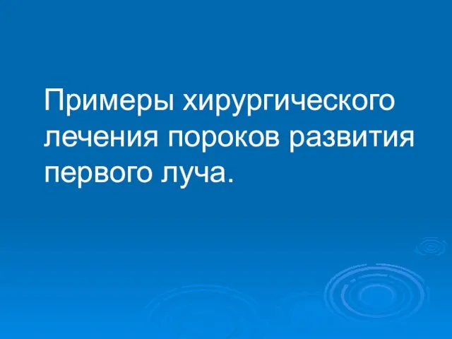 Примеры хирургического лечения пороков развития первого луча.