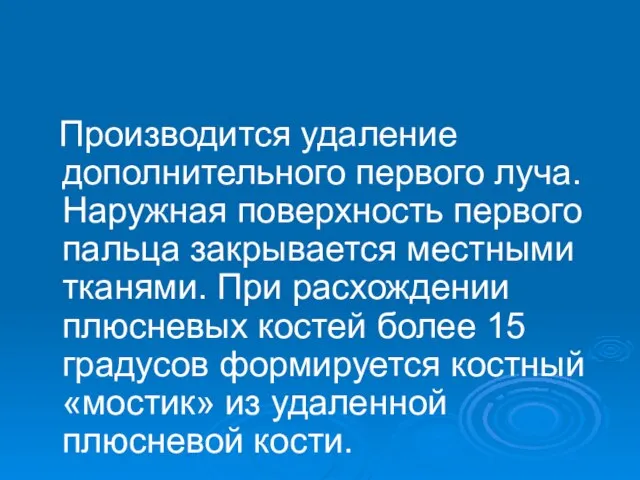 Производится удаление дополнительного первого луча. Наружная поверхность первого пальца закрывается местными