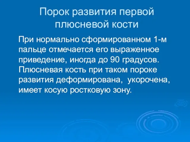 Порок развития первой плюсневой кости При нормально сформированном 1-м пальце отмечается