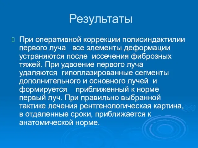 Результаты При оперативной коррекции полисиндактилии первого луча все элементы деформации устраняются