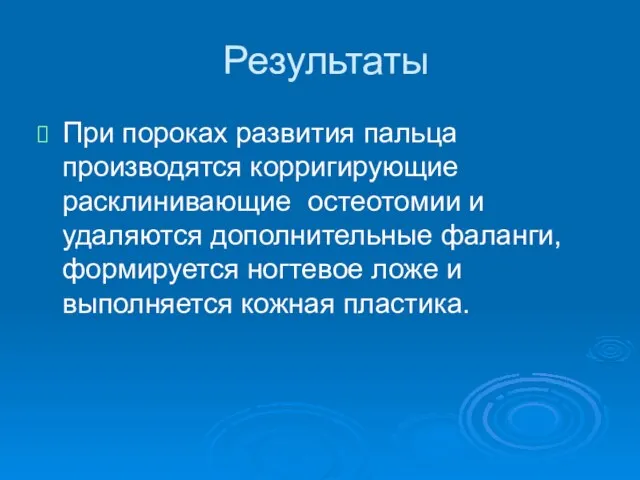 Результаты При пороках развития пальца производятся корригирующие расклинивающие остеотомии и удаляются