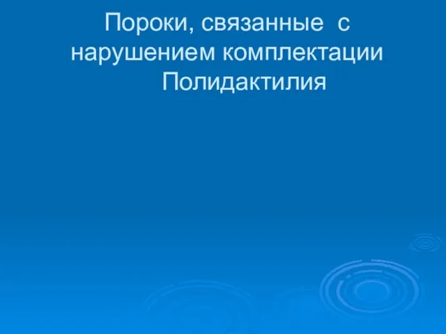 Пороки, связанные с нарушением комплектации Полидактилия