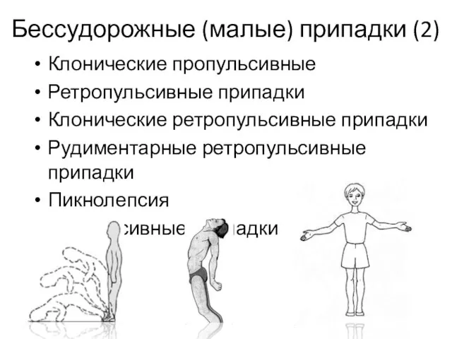 Бессудорожные (малые) припадки (2) Клонические пропульсивные Ретропульсивные припадки Клонические ретропульсивные припадки