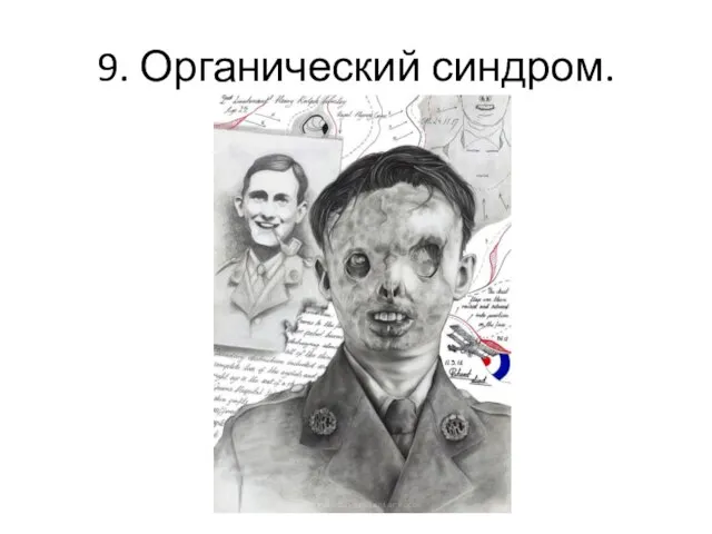 9. Органический синдром.