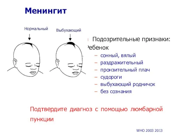 Менингит Подозрительные признаки: Ребенок сонный, вялый раздражительный пронзительный плач судороги выбухающий