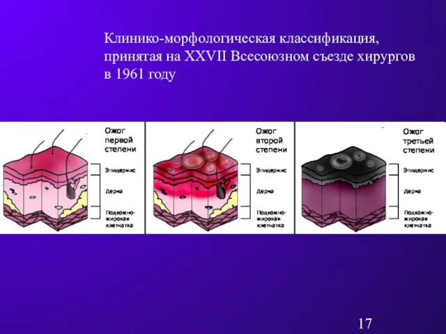 Клинико-морфологическая классификация, принятая на XXVII Всесоюзном съезде хирургов в 1961 году