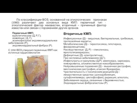 По классификации ВОЗ, основанной на этиологических признаках (1980) различают два основных