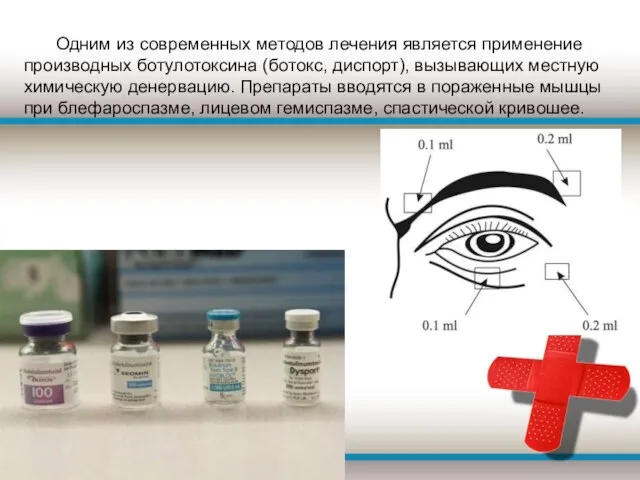 Одним из современных методов лечения является применение производных ботулотоксина (ботокс, диспорт),