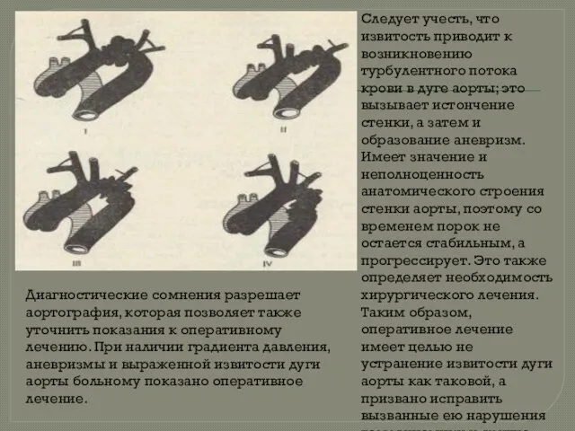 Следует учесть, что извитость приводит к возникновению турбулентного потока крови в