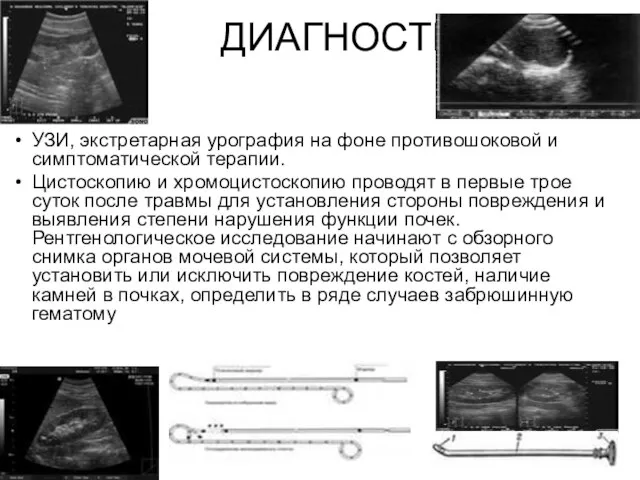 ДИАГНОСТИКА УЗИ, экстретарная урография на фоне противошоковой и симптоматической терапии. Цистоскопию