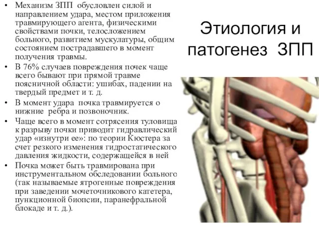 Этиология и патогенез ЗПП Механизм ЗПП обусловлен силой и направлением удара,