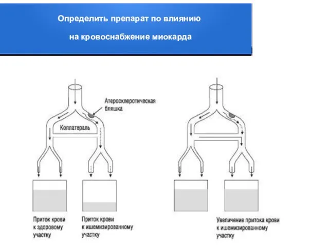 Определить препарат по влиянию на кровоснабжение миокарда