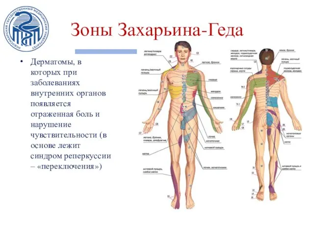 Зоны Захарьина-Геда Дерматомы, в которых при заболеваниях внутренних органов появляется отраженная