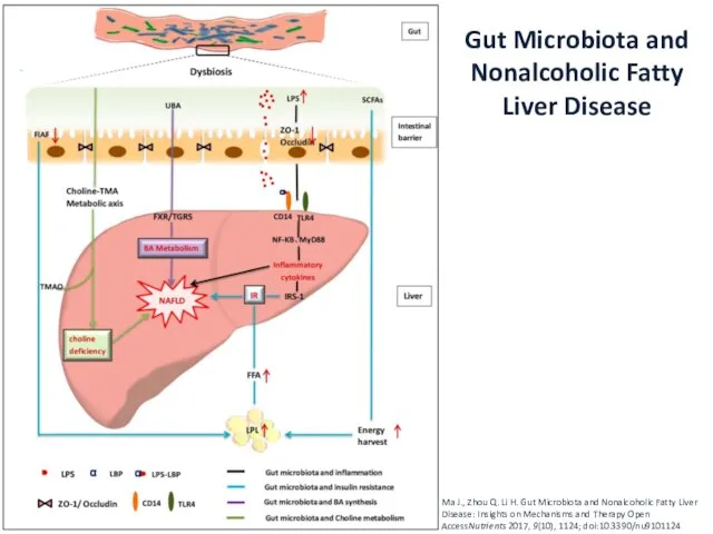 Gut Microbiota and Nonalcoholic Fatty Liver Disease Ma J., Zhou Q.