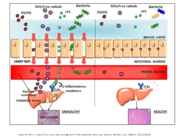 Poeta M, Pierri L, Vajro P. Gut–Liver Axis Derangement in Non-Alcoholic