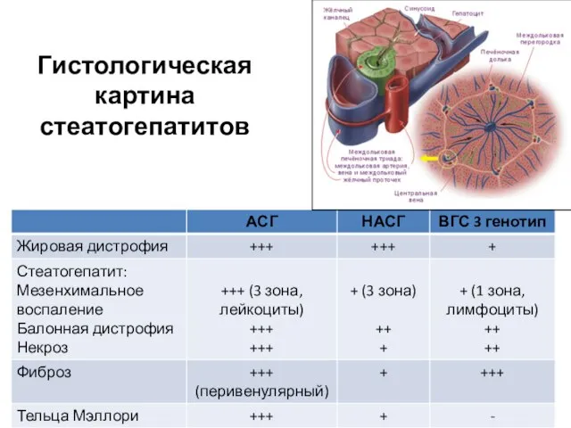 Гистологическая картина стеатогепатитов